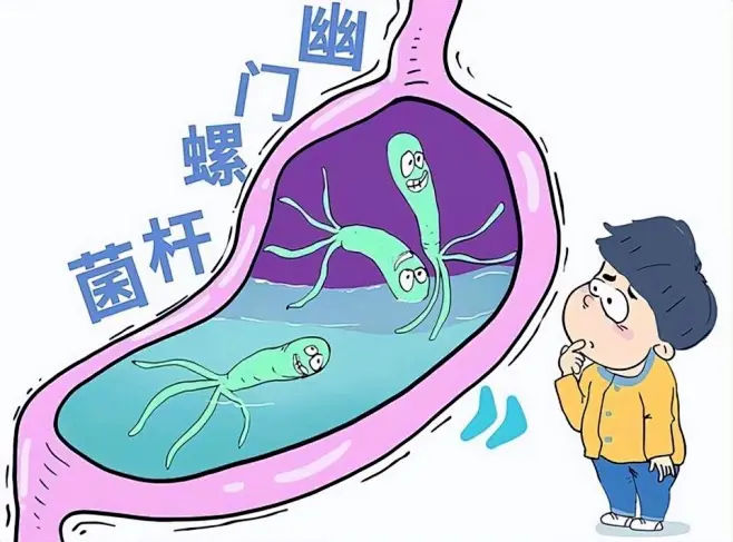 幽门螺杆菌：藏在胃里的“隐形杀手”，你了解多少？